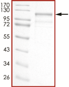 EGFR (d747-749), Active with mCherry